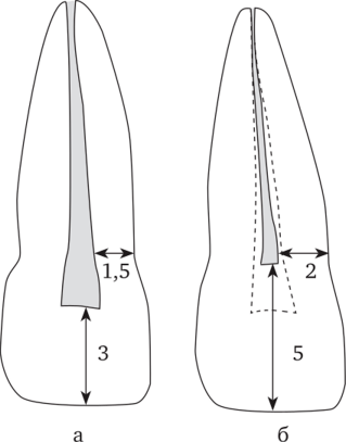 Толщина твердых тканей центрального постоянного резца верхней челюсти (мм) в зависимости от возраста